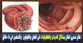 علاج سحرى لعلاج مشاكل الديدان والطفيليات فى البطن والقولون  والتحضير في 5 دقائق