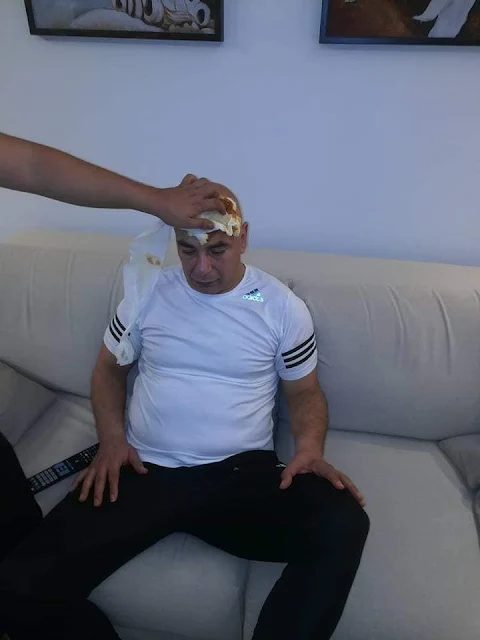 اصابة حسام حسن في مباراة المصري اصابة حسام حسن في مباراة المصري