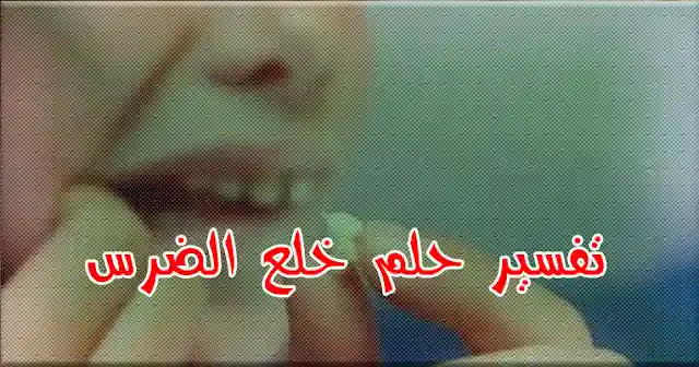تفسير حلم خلع الضرس في المنام تفسير حلم خلع الضرس في المنام